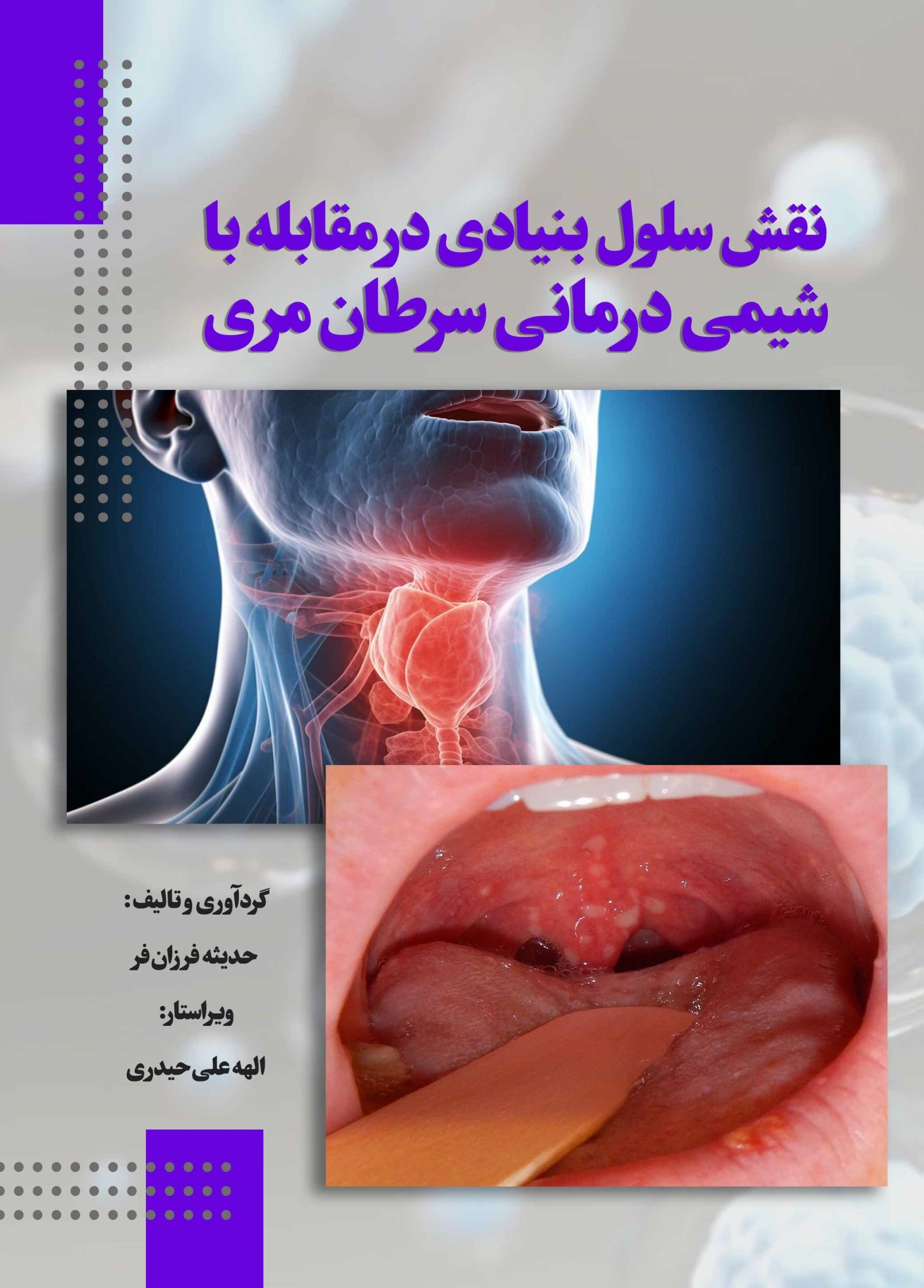 نقش سلول بنیادی در مقابله با شیمیدرمانی سرطان مری
